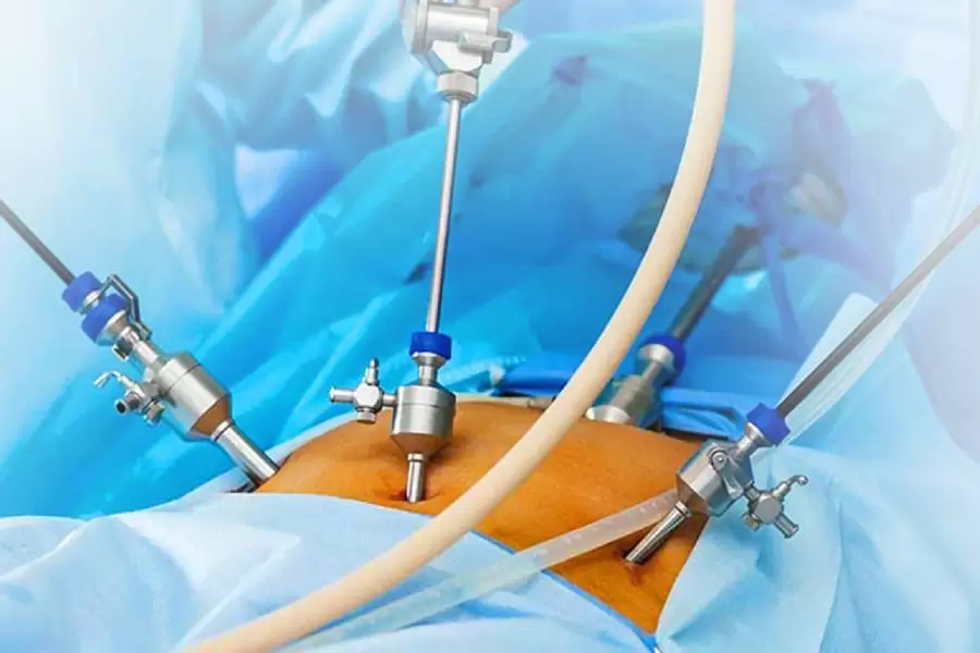 Laparoscopy