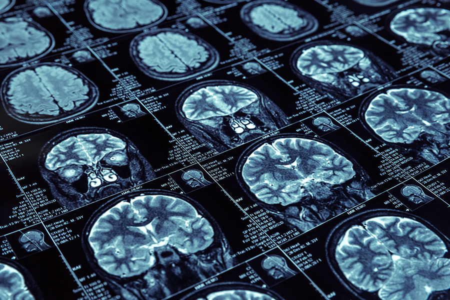Neurosurgery