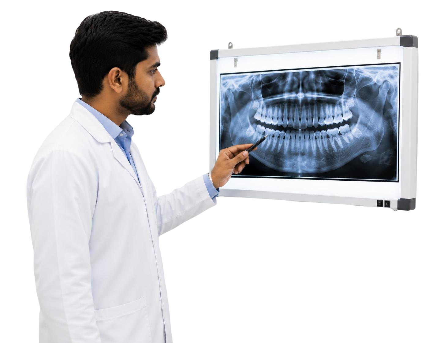 Dental x ray r