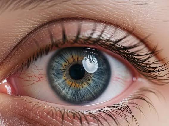 Conjunctivitis