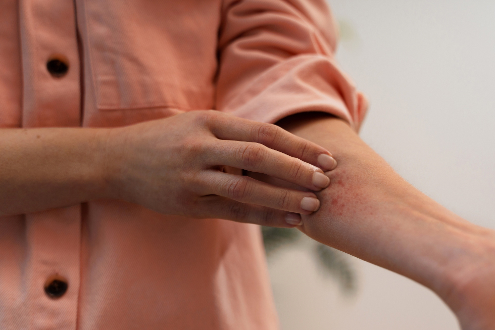 Fungal infection